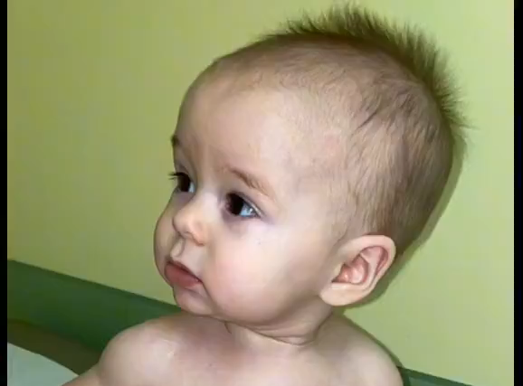 13 Day Timeline from Vaccine to Onset