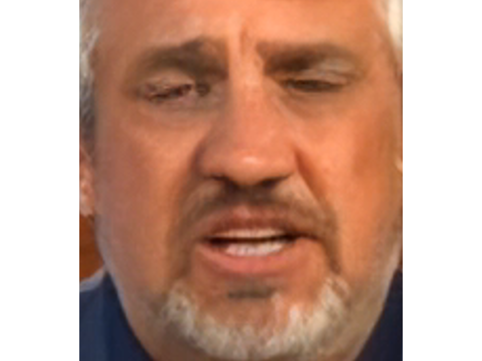 Del Bigtree’s Nose