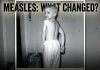 How Many People Have You Personally Known Who Died From Measles? greg-measles-what-changed