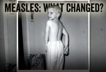 How Many People Have You Personally Known Who Died From Measles? greg-measles-what-changed