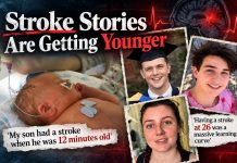 CDC Flagged a Stroke Signal in Seniors. Now the Stories Are Getting Younger strokes young people